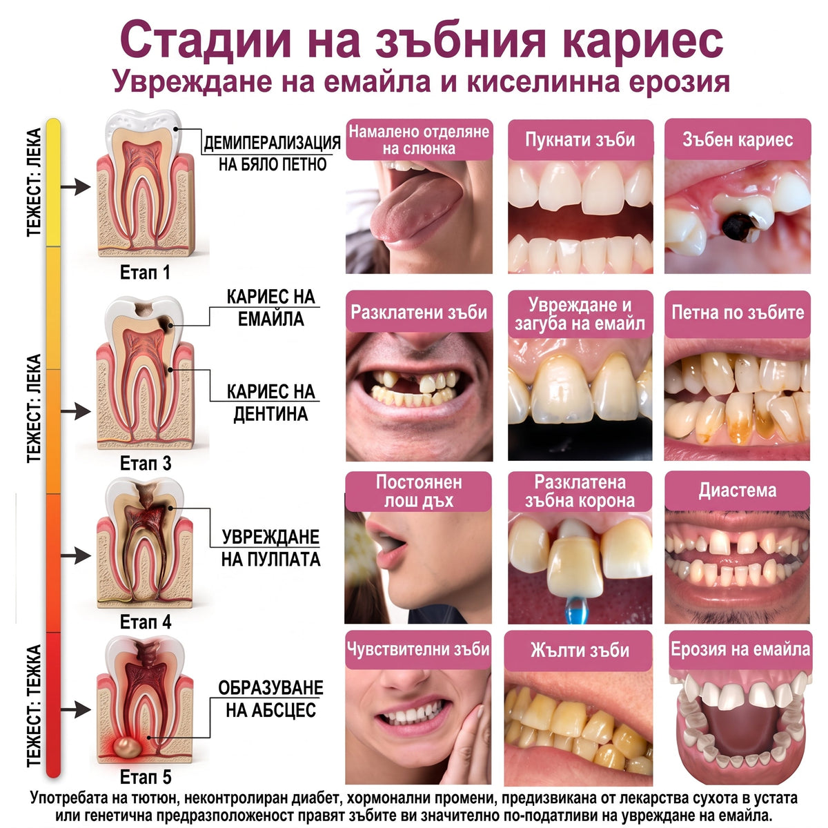 Keyess® DenPerm🎉🪶🪶 — Възстановяване при кариес Натурален гел за запьлване на зъбния емайл, Чувствителни зъби и отслабен емайл