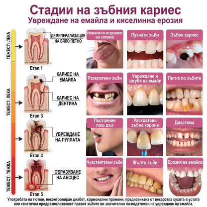 Keyess® DenPerm🎉🪶🪶 — Възстановяване при кариес Натурален гел за запьлване на зъбния емайл, Чувствителни зъби и отслабен емайл