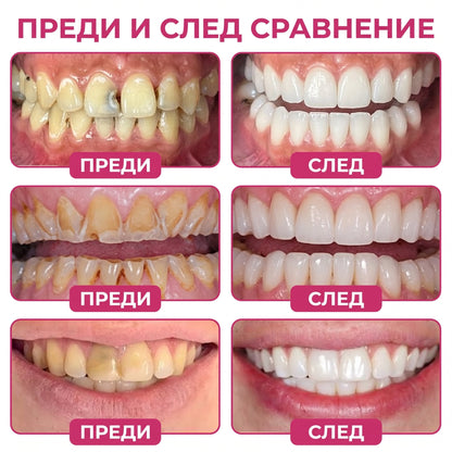 Keyess® DenPerm🎉🪶🪶 — Възстановяване при кариес Натурален гел за запьлване на зъбния емайл, Чувствителни зъби и отслабен емайл